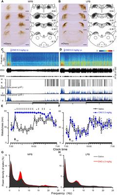 Medial Parabrachial Nucleus Is Essential in Controlling Wakefulness in Rats